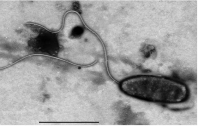 Bệnh hoại tử cơ, trắng đuôi, đục cơ trên Tôm 