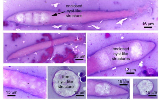 bệnh tôm bị phân trắng