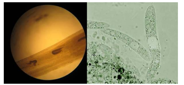 tôm bị bệnh phân trắng